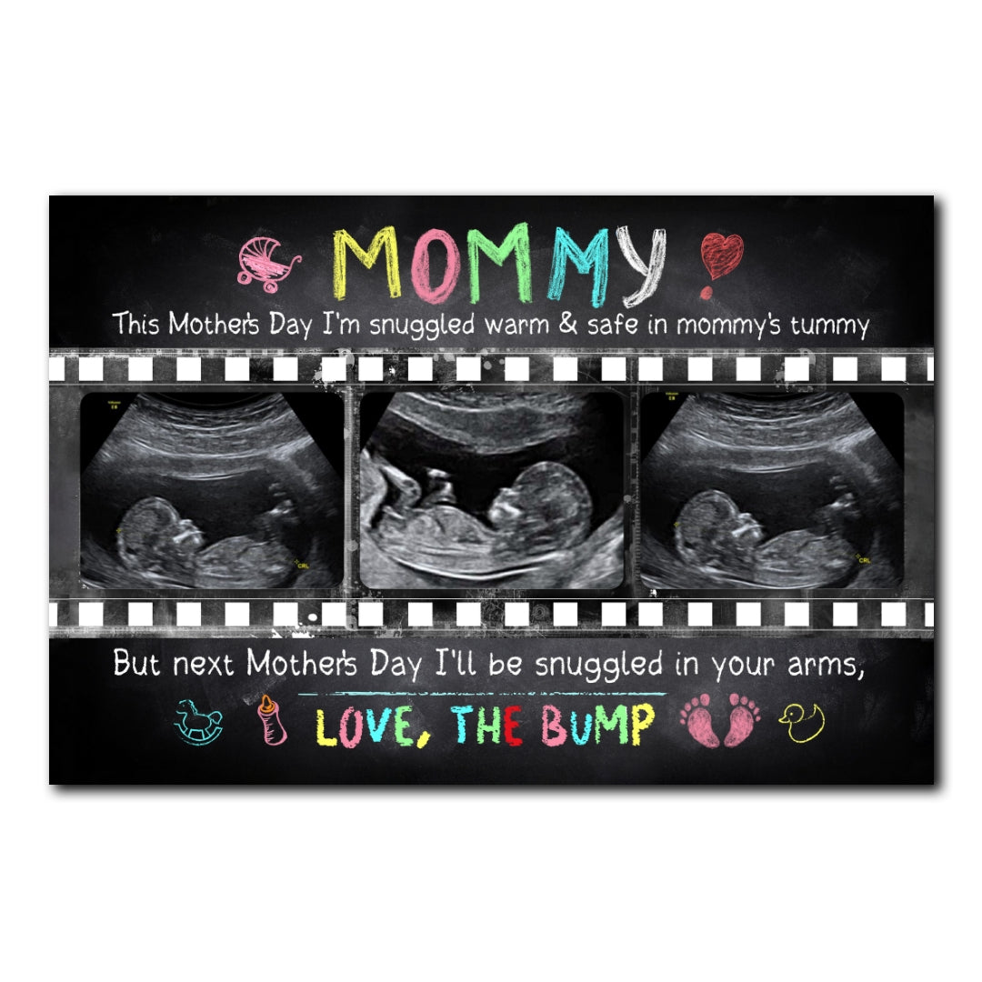 Personalized Mother's Day Gift For Expecting Mom Ultrasound Photo In Mommy's Tummy Poster