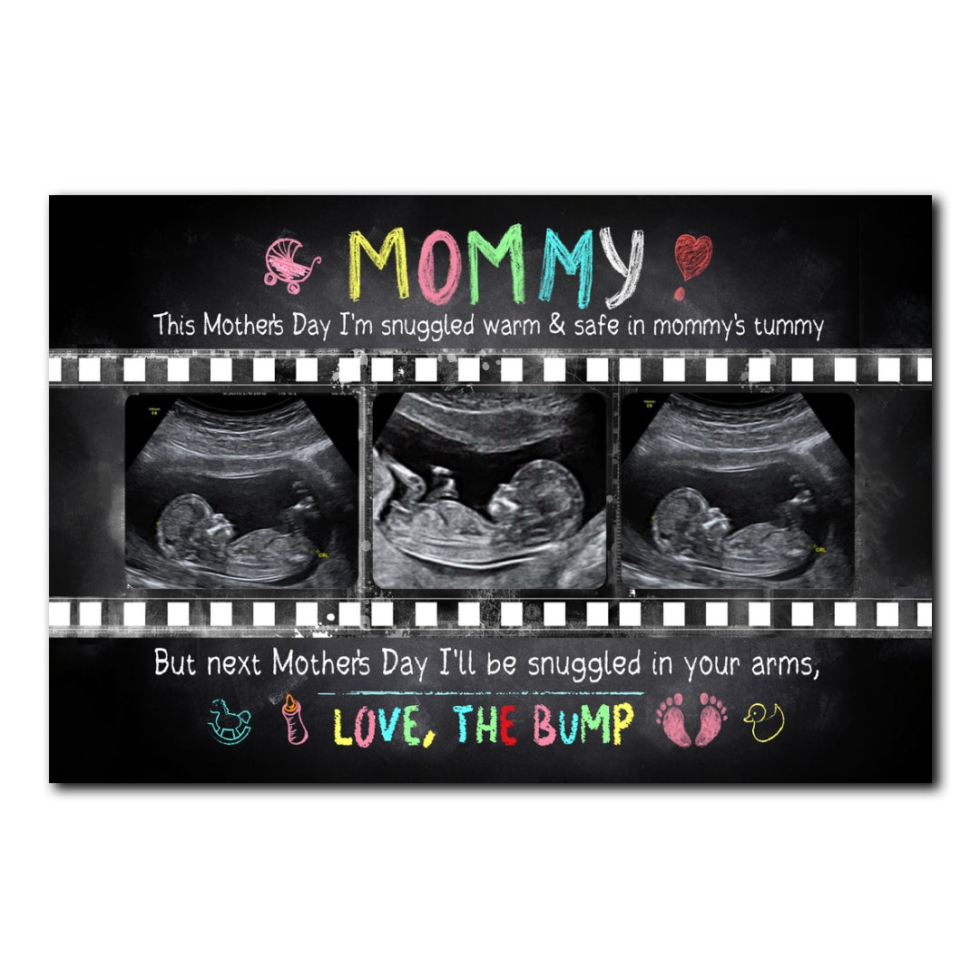 Personalized Mother's Day Gift For Expecting Mom Ultrasound Photo In Mommy's Tummy Poster