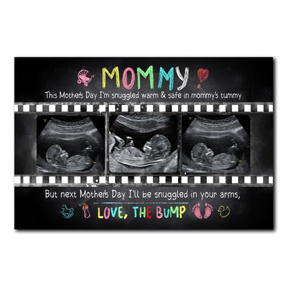 Personalized Mother's Day Gift For Expecting Mom Ultrasound Photo In Mommy's Tummy Poster