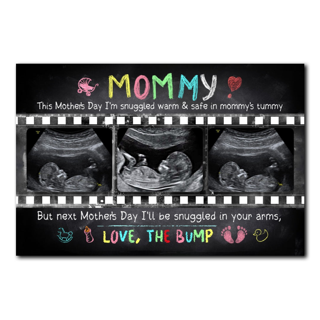Personalized Mother's Day Gift For Expecting Mom Ultrasound Photo In Mommy's Tummy Poster