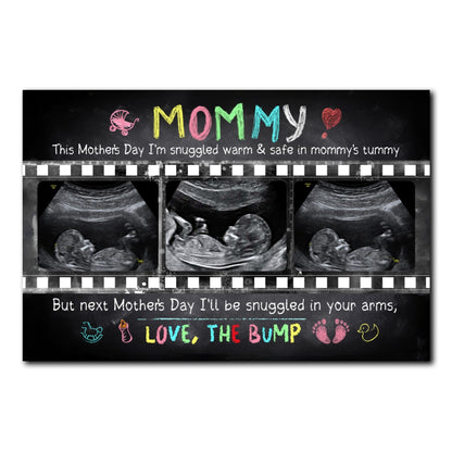 Personalized Mother's Day Gift For Expecting Mom Ultrasound Photo In Mommy's Tummy Poster