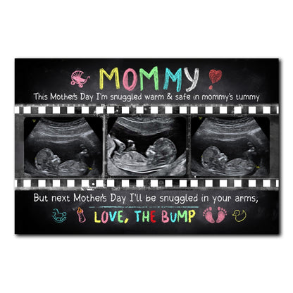 Personalized Mother's Day Gift For Expecting Mom Ultrasound Photo In Mommy's Tummy Poster