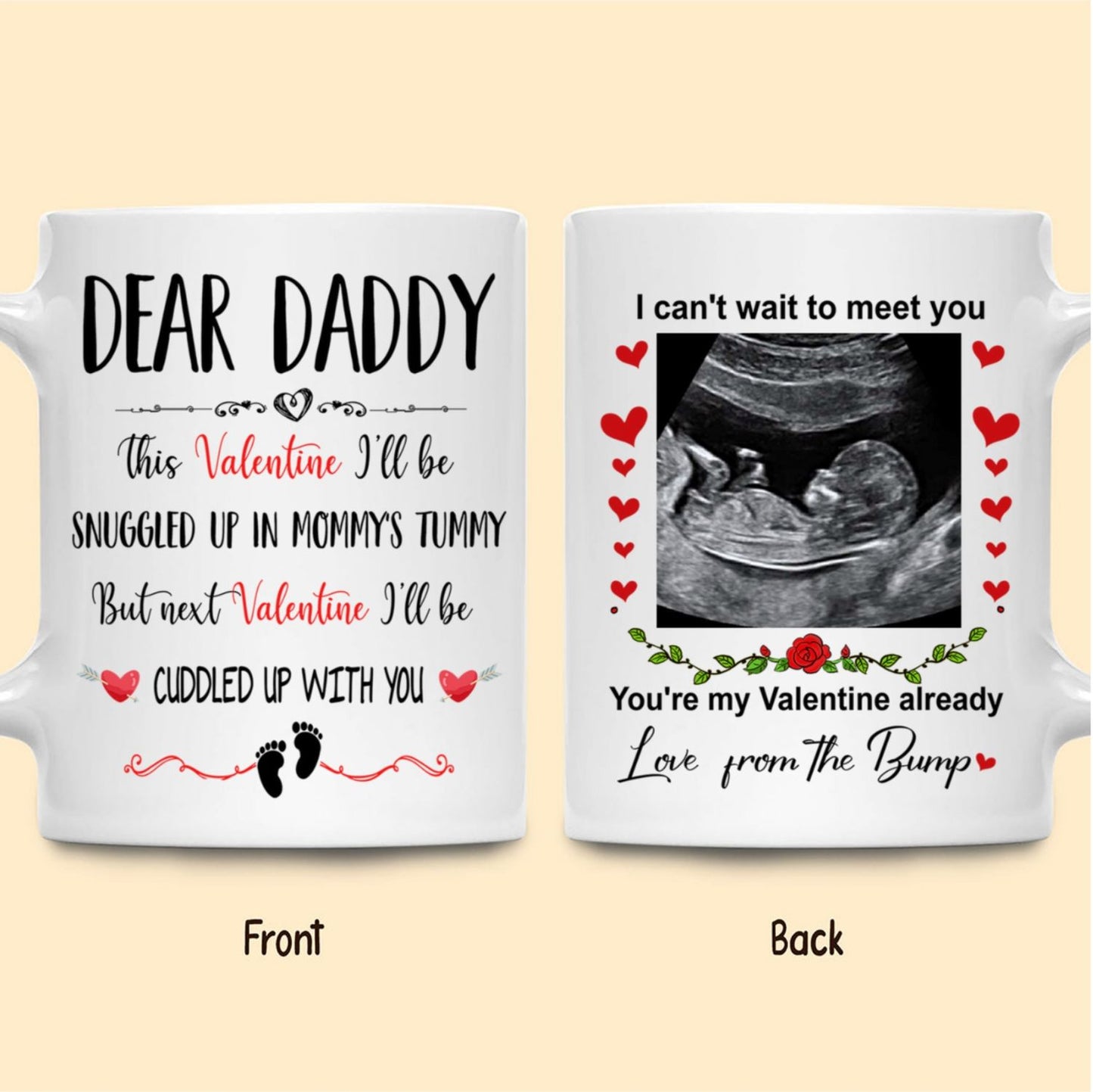 Ultrasound This Valentine Expecting Dad Personalized Mug Gift For Dad To Be