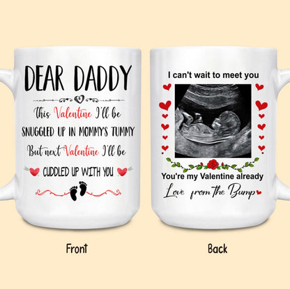 Ultrasound This Valentine Expecting Dad Personalized Mug Gift For Dad To Be