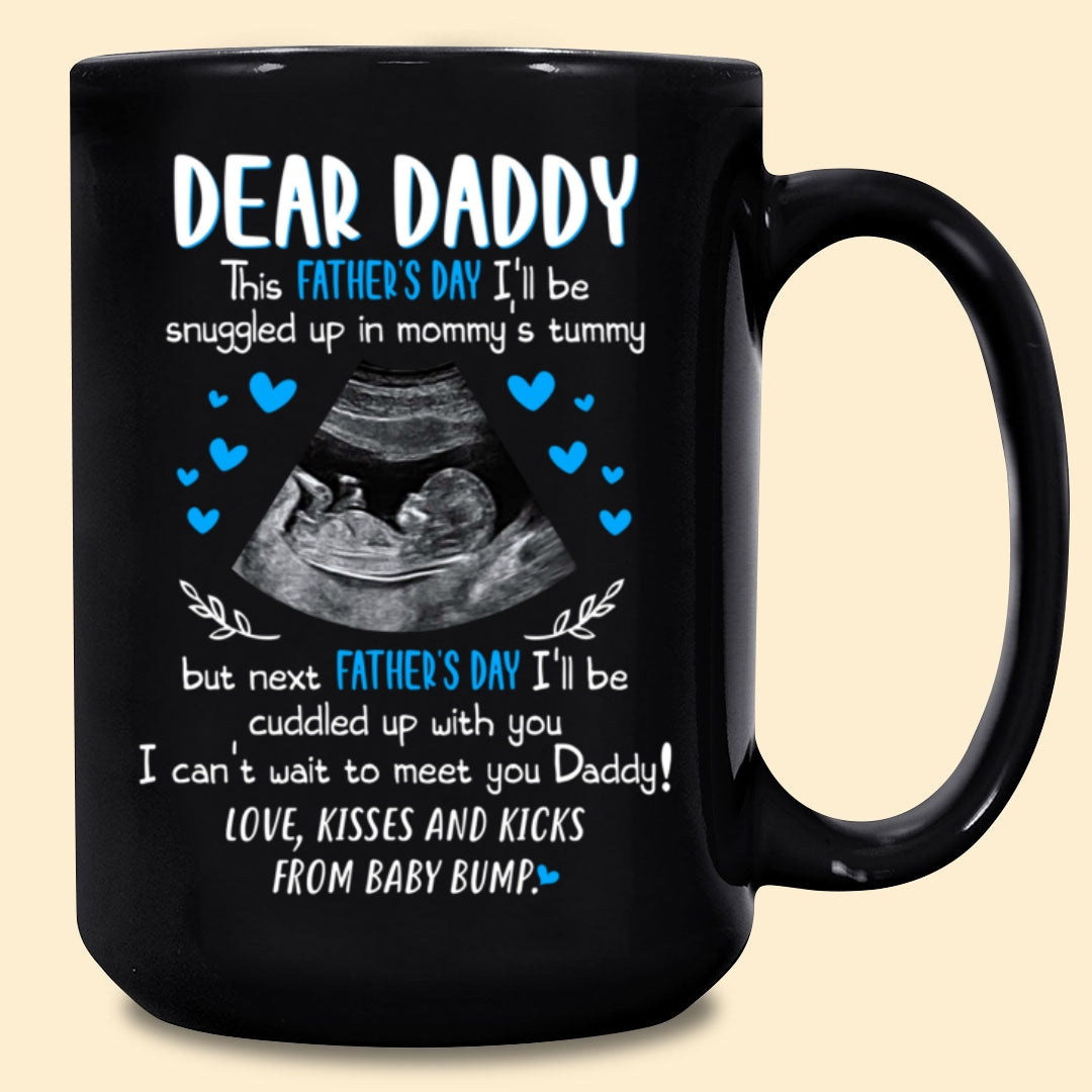 For Dad Cuddle Up With You Personalized Ultrasound Father’s Day Mug
