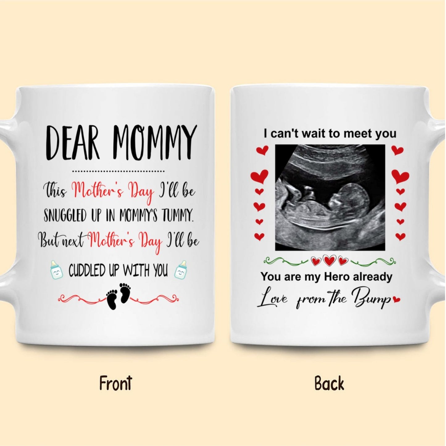 Mother's Day Mommy To Be Ultrasound Mommy Snuggled Personalized Mug