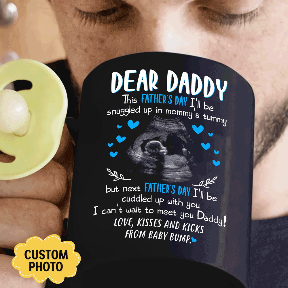 For Dad Cuddle Up With You Personalized Ultrasound Father’s Day Mug